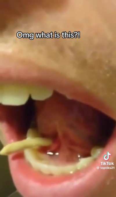 What is that?