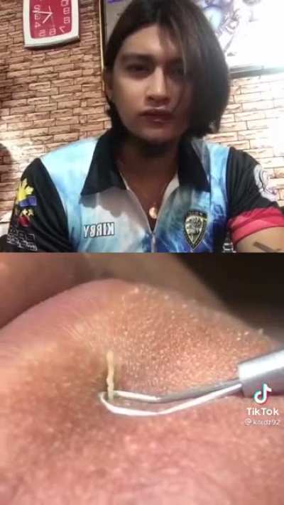 Mijoj