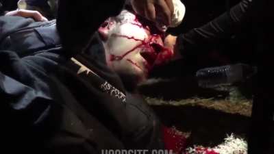 Protester Shot In The Head With Rubber Bullet In Portland