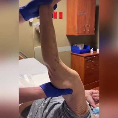 This Womans Arm