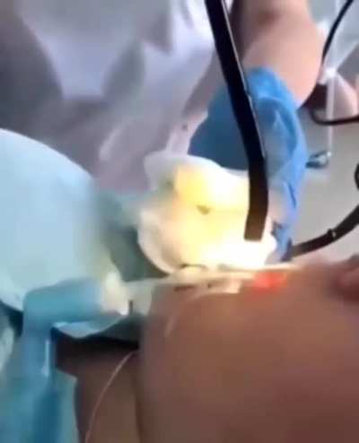 Medics pull 4ft snake from woman&rsquo;s mouth after it slithered down there while she slept.