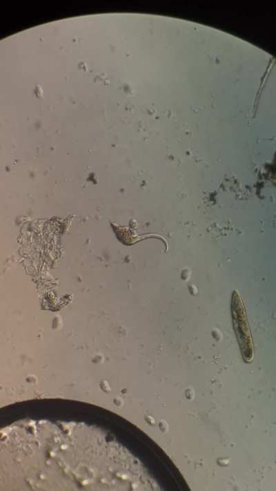 Probably my best footage yet. Dileptus killing and eating a fairly large ciliate