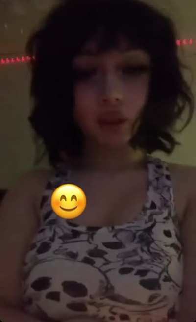 Ig story