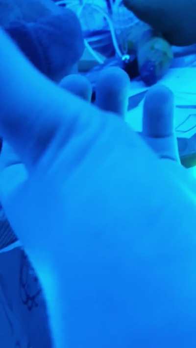 My perculiar thumb