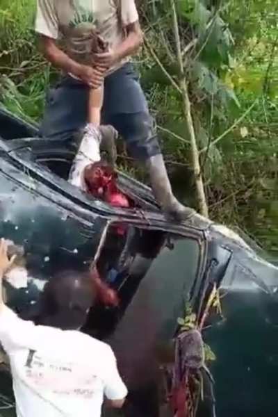 Nasty car crash leaves victim&rsquo;s skull and loose face hanging from remaining tissue.