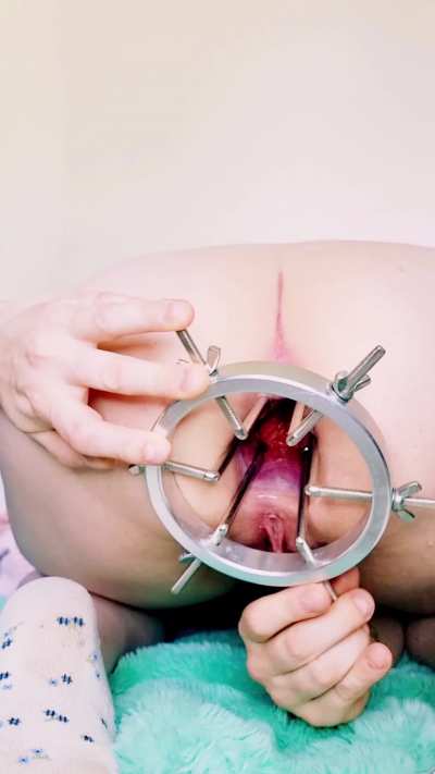 My anal expander adventure 