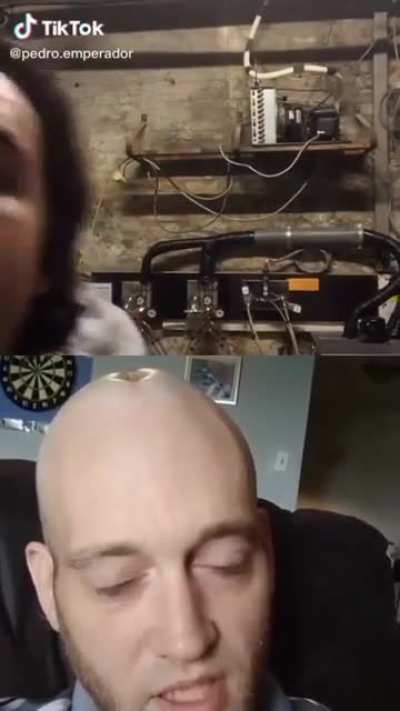 Xd