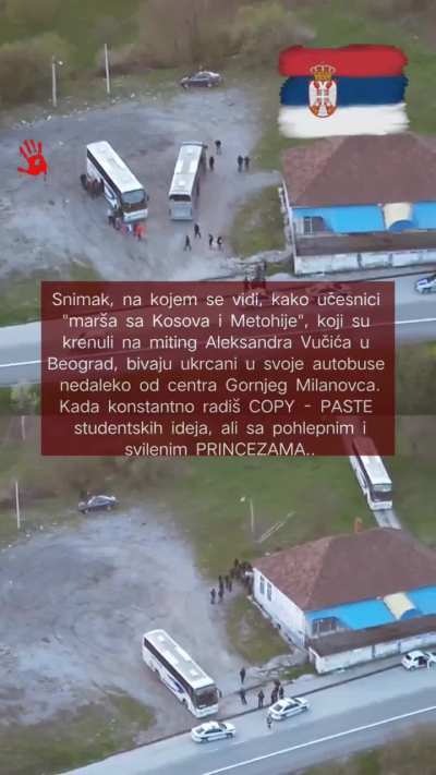 Jer ih bole "&scaron;apice" od hodanja...