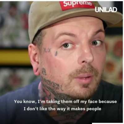 This tattoo artist removes rasict tattoos for free