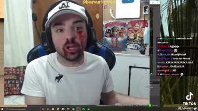 el accidente del papu :v
