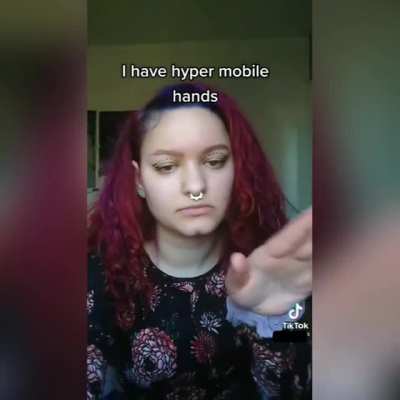 lmao that&rsquo;s NOT hypermobility&hellip;pretty sure most ppl can do this anyway