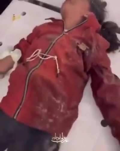 Children in Gaza still have to endure surgeries and major procedures without anesthesia because no medications are being allowed in and all the hospitals have been razed to the ground