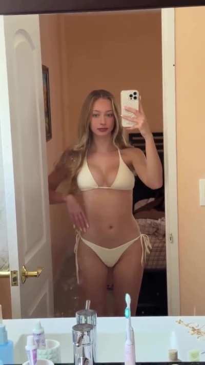 Ig story