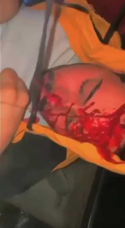 WCGW when you ride with reckless idiots