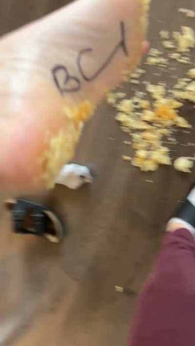 Crunchy feet