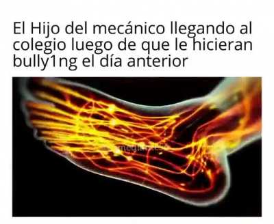 💀
