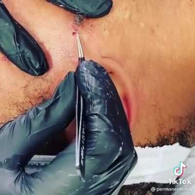 Physical Cringe