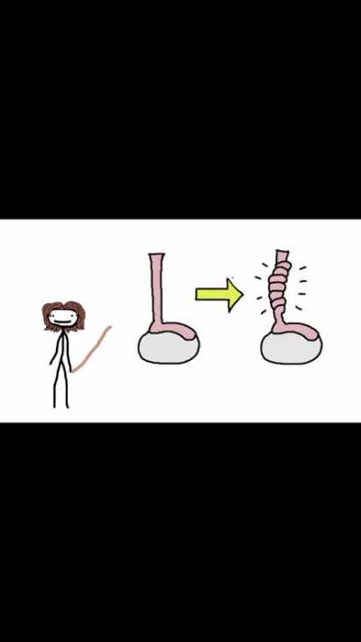 Testicular 