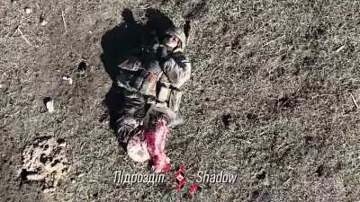 Russian soldier&rsquo;s leg VS 🧨💥
