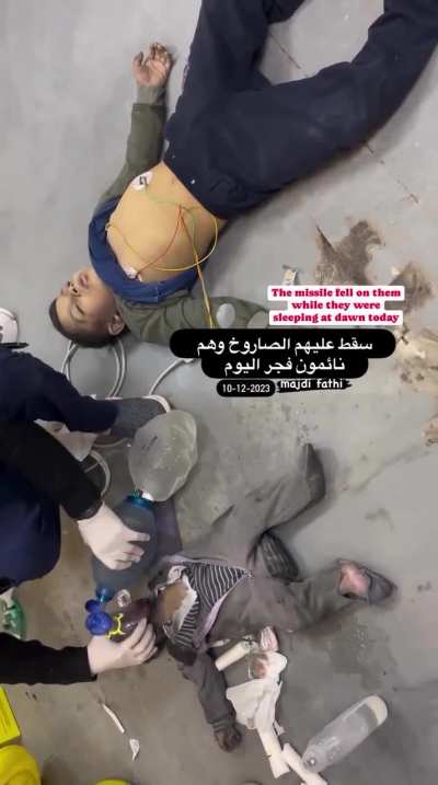 Children suffer from burns and injuries by an Israeli air strike that bombed their home whilst they were sleeping, pre dawn today. 10.12.23