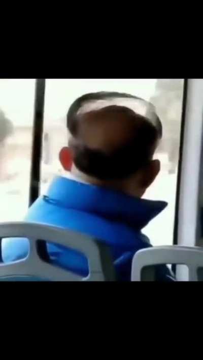 to not accept your hair loss