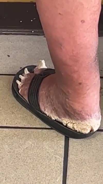 🤔 it looks itchy enough, btw can someone tell me what is this ? 