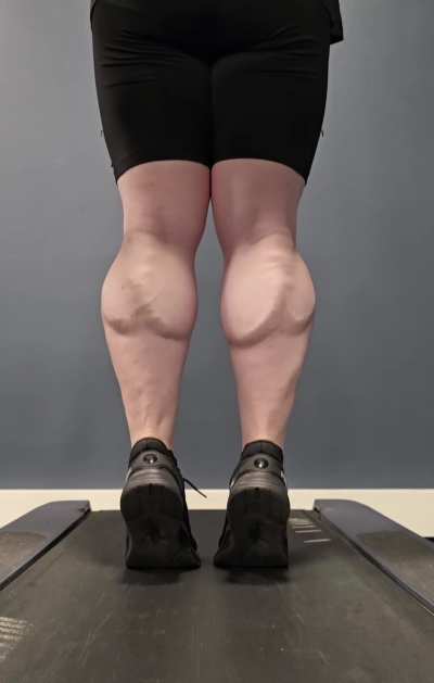 These calves turn heads at the gym