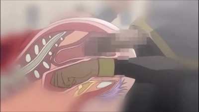 Hardcore fisting