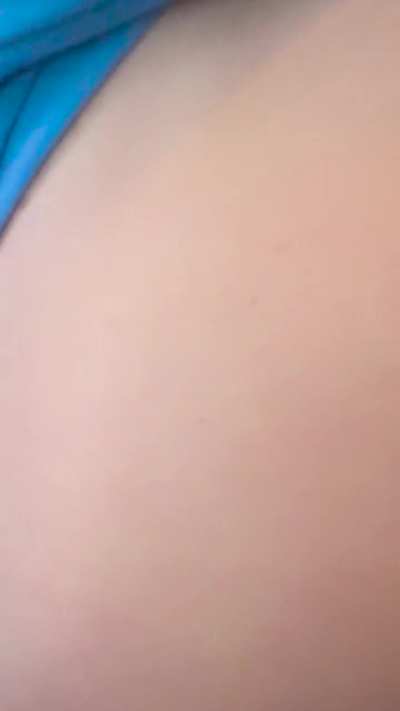 cyst on back gets popped and shoots out