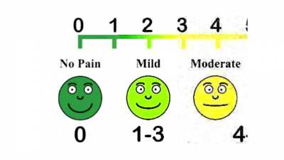 Pain scale