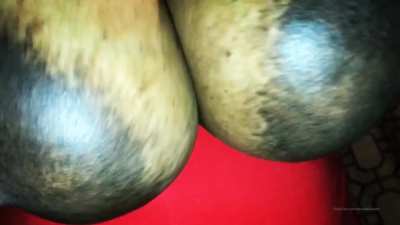 Huge areolas 
