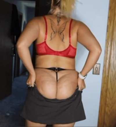 Thick or cellulite?