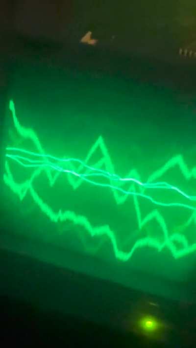 What happened to my boyfriend he just send me this video?? Is that a laser attacking him
