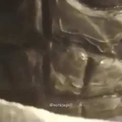 (*&acute;-`)