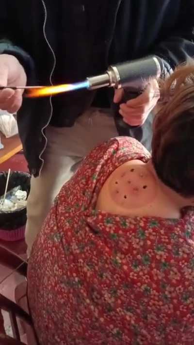 这是什么疗法