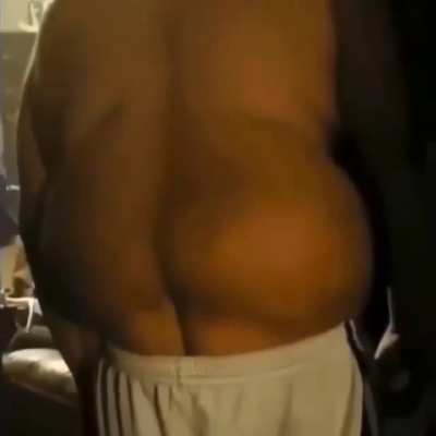 nigga need a Brazilian butt drop from dr miami hisself