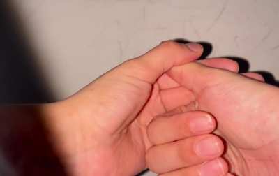 Does anyone else CLICK their thumbs like this?