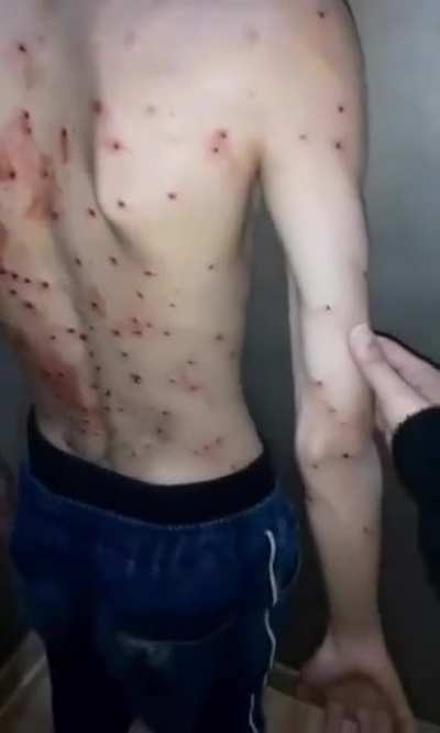 How does it look to take a ShutGun (Iran protest)