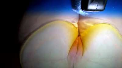 windshield pee