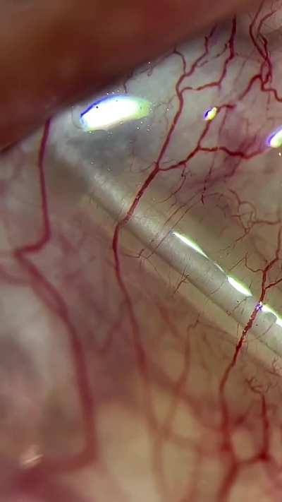 The eye is the most accessible places in the body to directly observe passage of the red blood corpuscles in a living person.