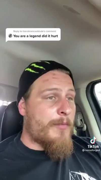 Guy on TikTok explains what it&rsquo;s like to be hit with lightning