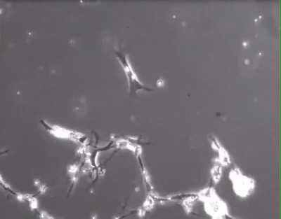 This is a timelapse of neurons making new connections to other neurons. This is what your thoughts look like