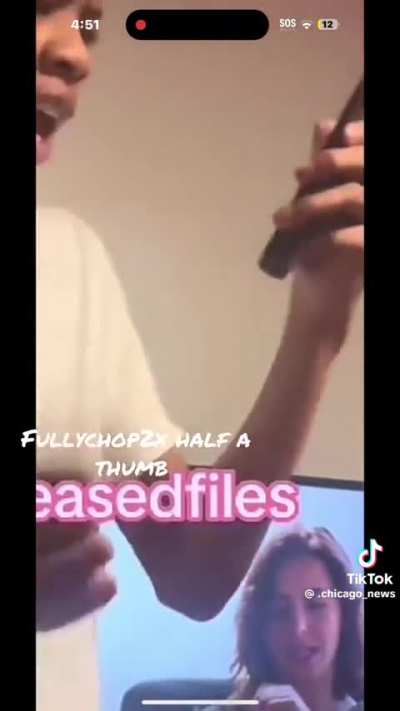 Bro really shot half of his thumb off 