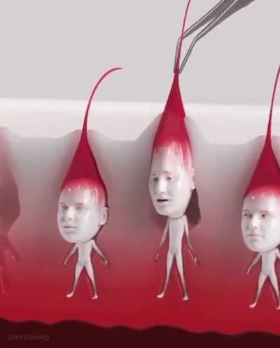 Thanks I hate this
