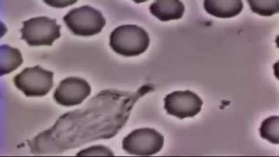 Globulo blanco vs bacteria