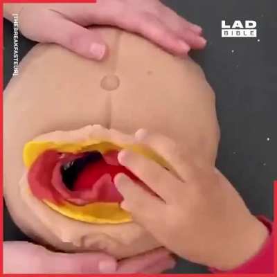 This doctor mum taught her four-year-old son - who wants to be a surgeon - how caesareans work by using playdough! Amazing Mum! And thus Spideyman was born! Brilliant