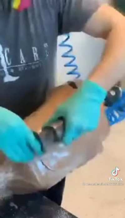 Amazing and life changing robotic prosthetics for this kid!