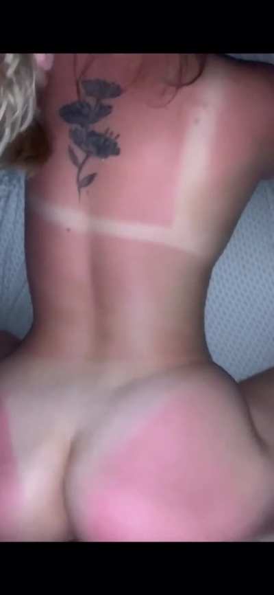 Don&rsquo;t worry I applied aloe on her shortly after...