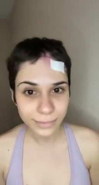 Woman with cancer records her journey to recovery, one step at a time 💪🎥💖