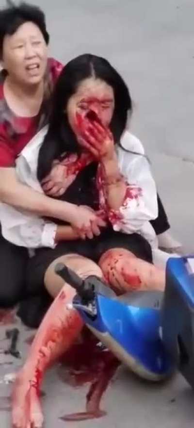 [LFO] Rolling Death Cycle, China 🇨🇳 (NAUSEATINGLY NSFL! YOU’VE BEEN WARNED!!)